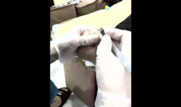 去除鸡眼视频,跟随视频教程学除法